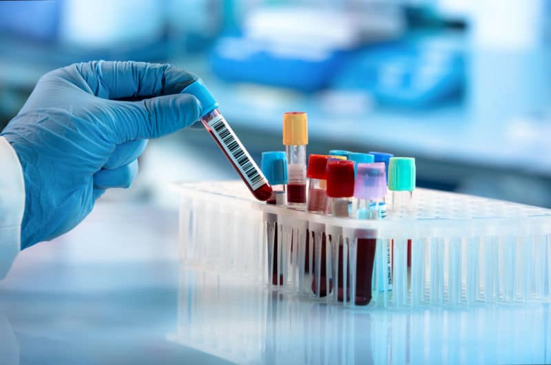 Private Blood Testing Birmingham Private Blood Testing Birmingham