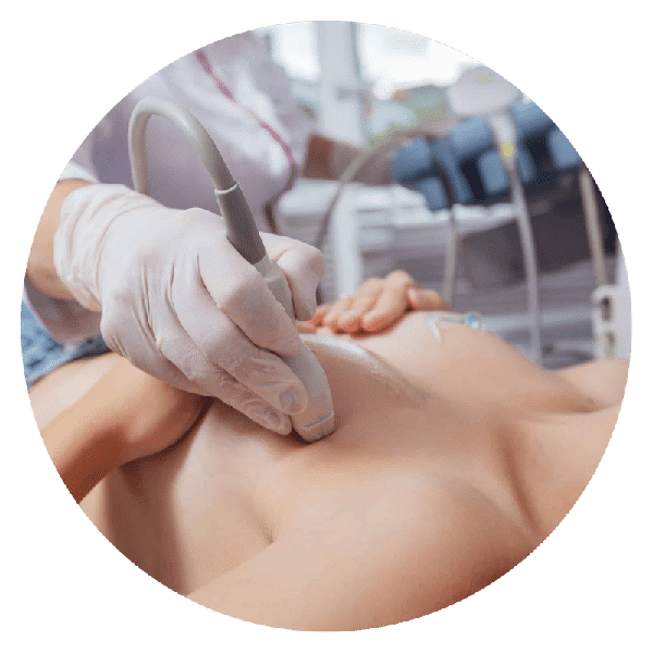 Role of Breast Ultrasound Scan in Early Cancer Detection Role of Breast Ultrasound Scan in Early Cancer Detection