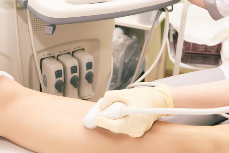 Fast DVT Scan Results Birmingham Fast DVT Scan Results Birmingham