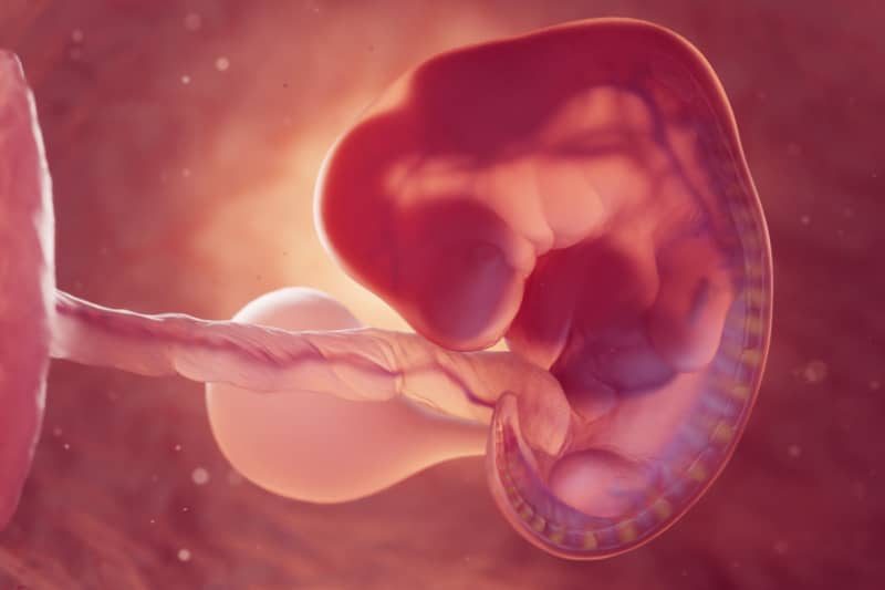 Gestational Age Gestational Age