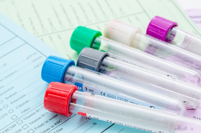 FBC Full Blood Count Test Universal Ultrasound Diagnostics FBC Full Blood Count Test Universal Ultrasound Diagnostics