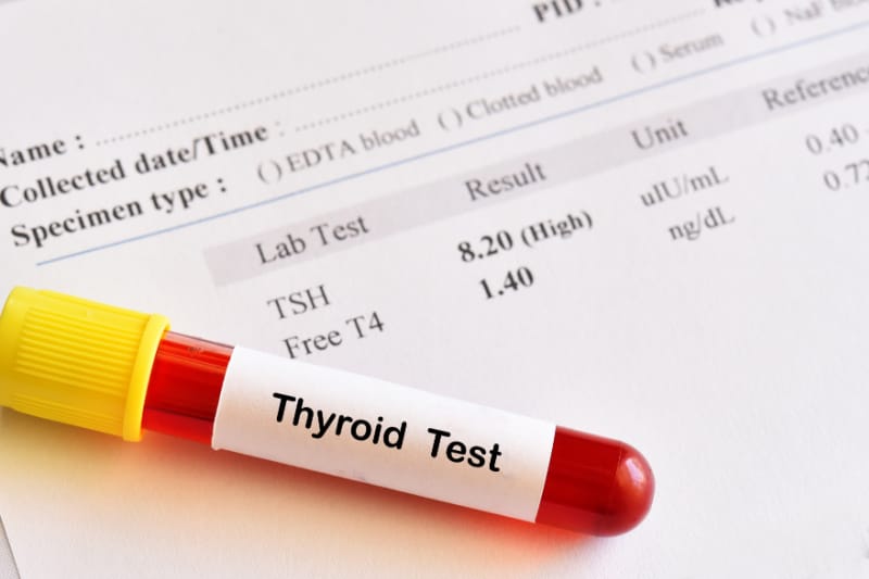 Thyroid function blood test at Universal Ultrasound Diagnostics Exercise and men's health outcomes