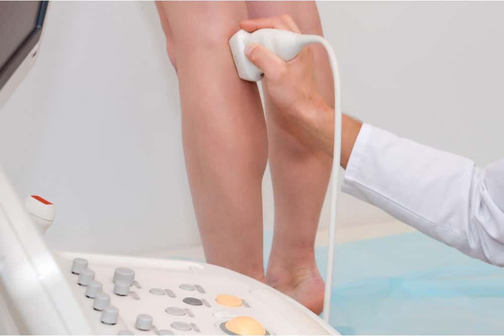Vascular Ultrasound Scan Vascular Ultrasound Scan