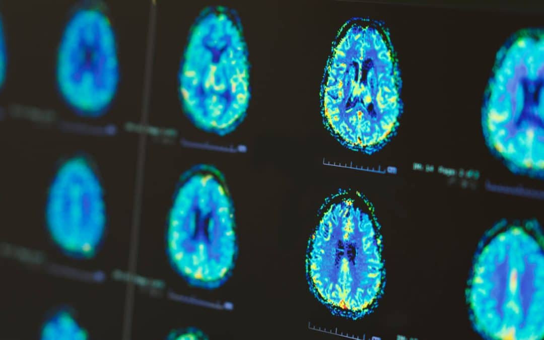 MRI or Ultrasound? How We Use Both to Look After Your Joints, Spine and Soft Tissues