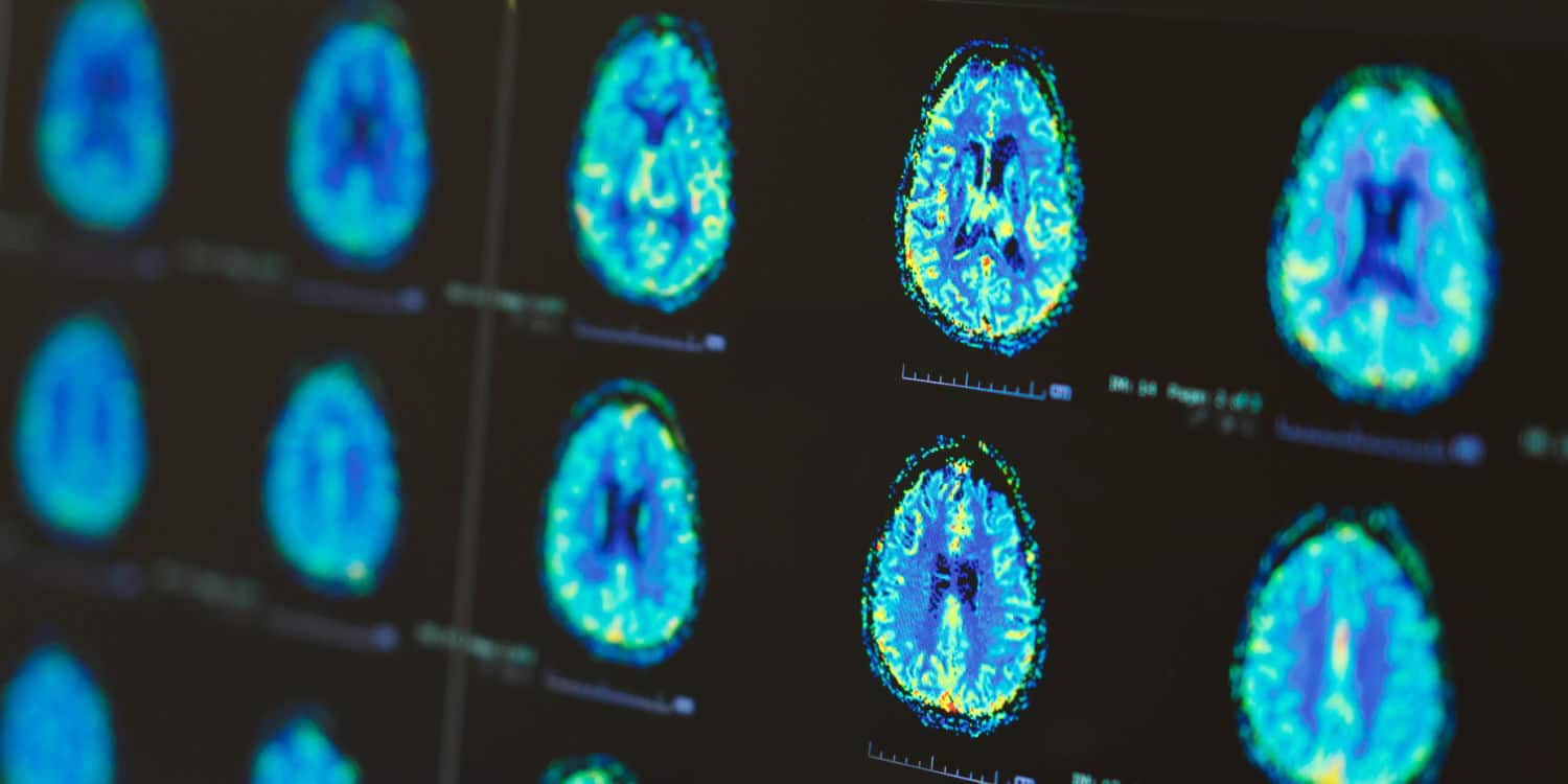 MRI Scans with Universal Ultrasound