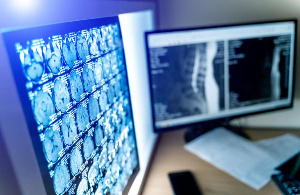 Private MRI Scans with Universal Ultrasound