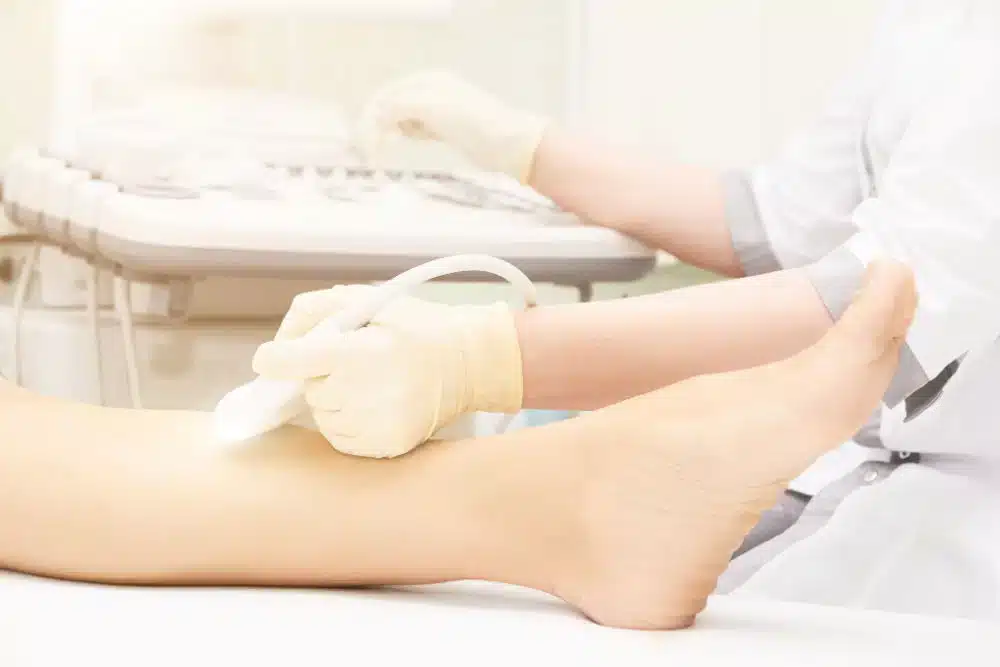 Deep Vein Thrombosis (DVT) Scan Book a Deep Vein Thrombosis (DVT) Scan