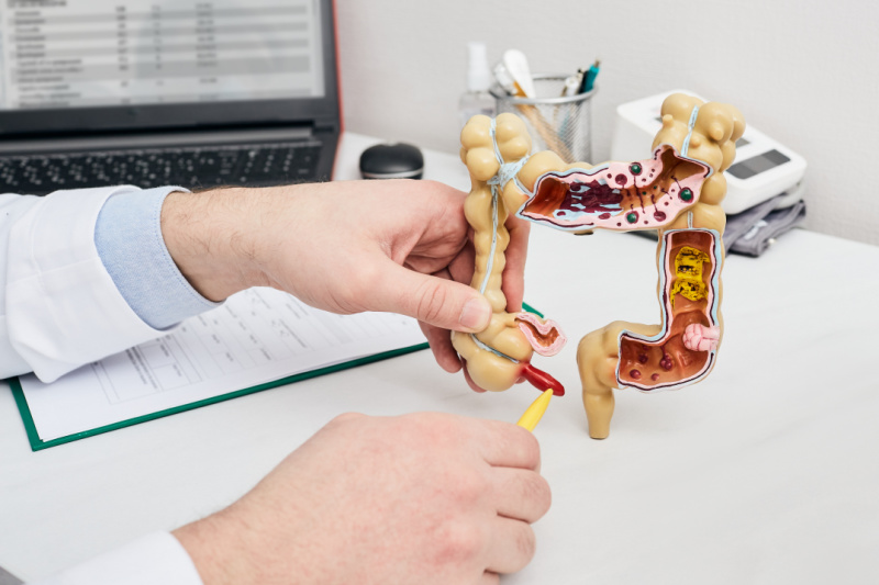 Image of An Appendix Model in a Doctors Office