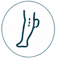 DVT